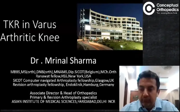 Total Knee Replacement in Varus Arthritic Knee | Dr. Mrinal Sharma