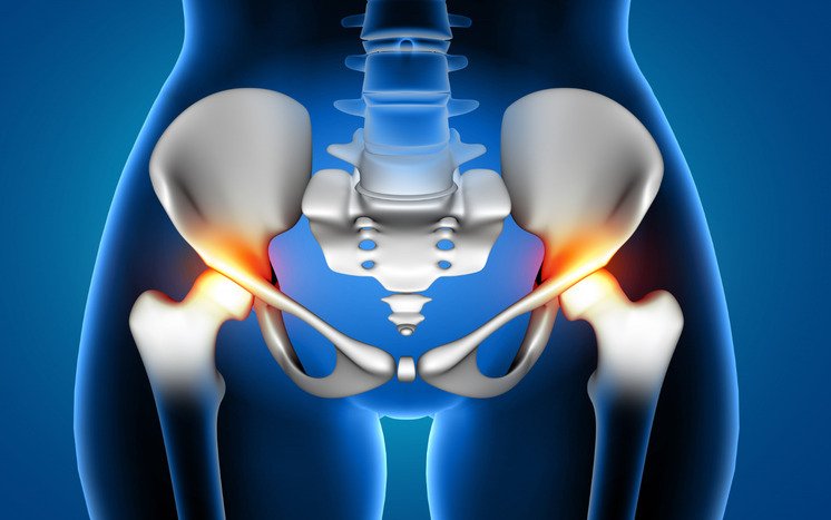 Life After Hip Replacement: What to Expect in 2024