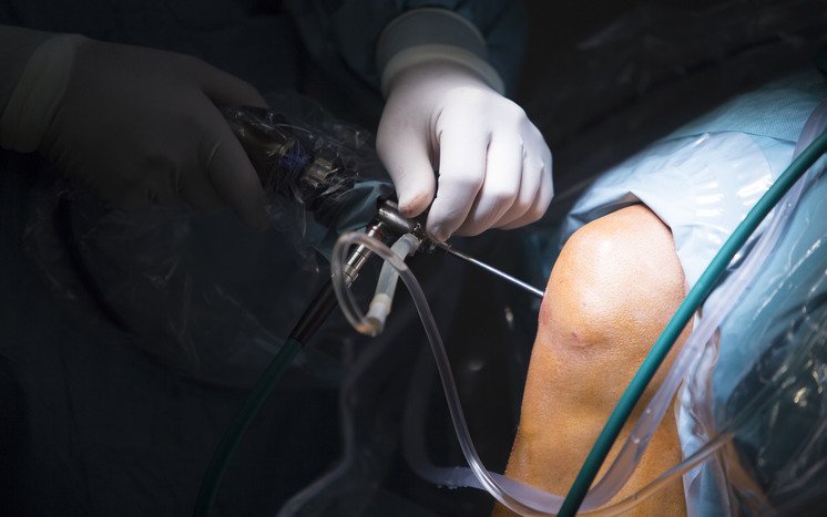 How Long Does a Robotic Knee Replacement Take?